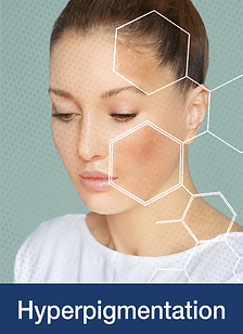 Hyperpigmentation