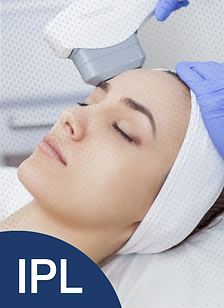 IPL คืออะไร