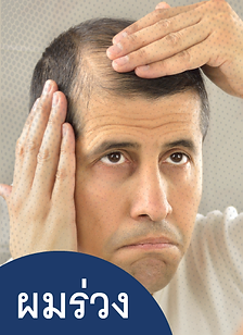 รักษาผมร่วง