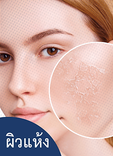 ผิวแห้ง วิธีสังเกตและทดสอบผิวแห้ง