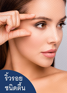 ริ้วรอยชนิดตื้น