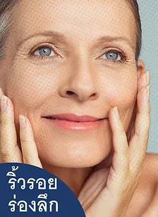 วิธีการรักษาริ้วรอยร่องลึก