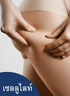 เซลลูไลท์